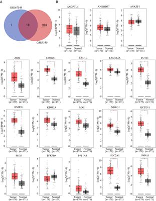 Hypoxia-Related Gene FUT11 Promotes Pancreatic Cancer Progression by Maintaining the Stability of PDK1